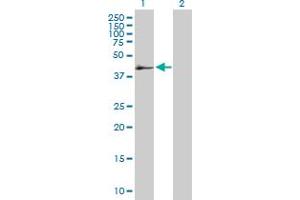 Western Blot analysis of SERPINB2 expression in transfected 293T cell line by SERPINB2 MaxPab polyclonal antibody. (SERPINB2 antibody  (AA 1-415))
