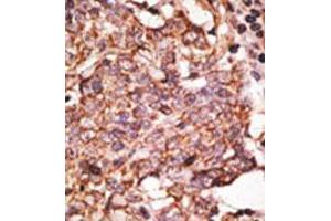 Image no. 2 for anti-Sialic Acid Binding Ig-Like Lectin 6 (SIGLEC6) (C-Term) antibody (ABIN357146) (SIGLEC6 antibody  (C-Term))