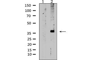Western blot analysis of extracts from rat muscle, using AVPR2 Antibody. (AVPR2 antibody  (Internal Region))