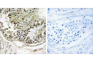 Peptide - +Immunohistochemistry analysis of paraffin-embedded human testis tissue using DYNLRB2 antibody. (DYNLRB2 antibody)