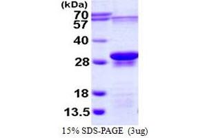 SDS-PAGE (SDS) image for Eukaryotic Translation Initiation Factor 3 Subunit J (EIF3S1) (AA 70-258) protein (His tag) (ABIN667972) (EIF3S1 Protein (AA 70-258) (His tag))