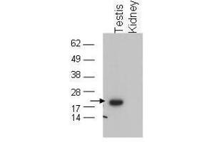 Western blot using  affinity purified anti-GPx4 to detect GPx4 in testis extract (arrow). (GPX4 antibody  (C-Term))