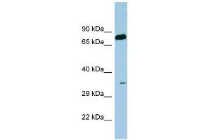WB Suggested Anti-SDS Antibody Titration:  0. (serine Dehydratase antibody  (N-Term))