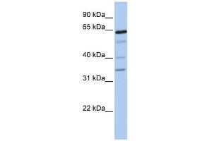 GALNTL1 antibody used at 1 ug/ml to detect target protein. (GALNTL1 antibody  (N-Term))