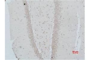Immunohistochemical analysis of paraffin-embedded Rat Brain Tissue using NMBR Polyclonal Antibody. (NMBR antibody)