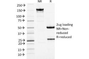 SDS-PAGE (SDS) image for anti-Minichromosome Maintenance Complex Component 7 (MCM7) (AA 195-319) antibody (ABIN6940019)
