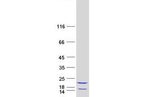 Validation with Western Blot (EIF5A2 Protein (Myc-DYKDDDDK Tag))