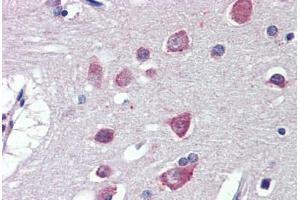 Brain, cortex, Human: Formalin-Fixed, Paraffin-Embedded (FFPE) (Fatty Acid Synthase antibody  (AA 2118-2129))
