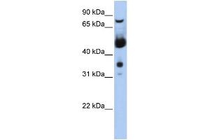 WB Suggested Anti-MNAT1  Antibody Titration: 0. (MNAT1 antibody  (N-Term))