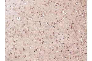 Paraformaldehyde-fixed, paraffin embedded rat brain, Antigen retrieval by boiling in sodium citrate buffer (pH6) for 15min, Block endogenous peroxidase by 3% hydrogen peroxide for 30 minutes, Blocking buffer (normal goat serum) at 37°C for 20min, Antibody incubation with RPS6KA1(Thr348) Polyclonal Antibody  at 1:400 overnight at 4°C, followed by a conjugated secondary and DAB staining. (RPS6KA1 antibody  (pThr348))