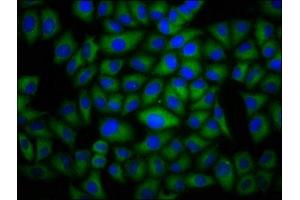 Immunofluorescence staining of Hela cells with ABIN7150914 at 1:100, counter-stained with DAPI. (Dysferlin antibody  (AA 105-278))