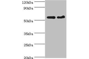 Western blot All lanes: CDK16 antibody at 5 μg/mL Lane 1: Mouse brain tissue Lane 2: Mouse small intestine tissue Secondary Goat polyclonal to rabbit IgG at 1/10000 dilution Predicted band size: 56, 64, 57 kDa Observed band size: 56 kDa (CDK16 antibody  (AA 277-496))