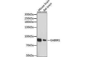Western blot analysis of extracts of various cell lines, using G antibody (ABIN6131686, ABIN6140882, ABIN6140883 and ABIN6214785) at 1:1000 dilution. (GABBR1 antibody  (AA 200-460))