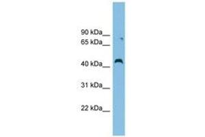 Image no. 1 for anti-Collagen and Calcium Binding EGF Domains 1 (CCBE1) (AA 287-336) antibody (ABIN6744980) (CCBE1 antibody  (AA 287-336))