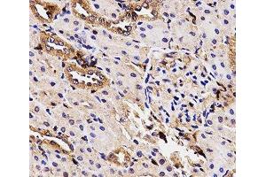 Immunohistochemistry of paraffin-embedded Rat kidney using BCHE Polyclonal Antibody at dilution of 1:100 (40x lens). (Butyrylcholinesterase antibody)