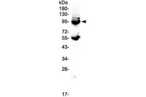 Western blot testing of mouse lung tissue lysate with CD105 antibody at 0.