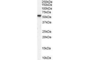 TPTE antibody  (Internal Region)