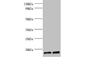 Western blot All lanes: FKBP1A antibody at 2 μg/mL Lane 1: EC109 whole cell lysate Lane 2: 293T whole cell lysate Secondary Goat polyclonal to rabbit IgG at 1/15000 dilution Predicted band size: 12 kDa Observed band size: 12 kDa (FKBP1A antibody  (AA 2-103))