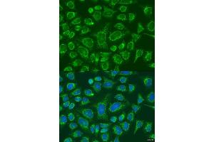 Immunofluorescence analysis of U2OS cells using FCGR3B antibody (ABIN6292672) at dilution of 1:100. (FCGR3B antibody)