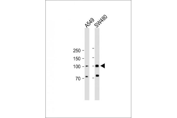 RASGRP1 anticorps  (AA 495-521)