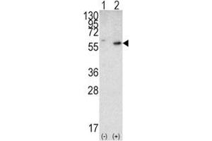 Western Blotting (WB) image for anti-Phosphatase and Tensin Homolog (PTEN) (AA 69-104) antibody (ABIN3032214)