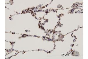 Immunoperoxidase of monoclonal antibody to FBXW7 on formalin-fixed paraffin-embedded human lung. (FBXW7 antibody  (AA 599-707))
