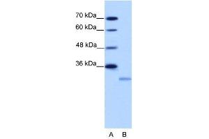 WB Suggested Anti-EIF4E2  Antibody Titration: 2. (EIF4E2 antibody  (N-Term))