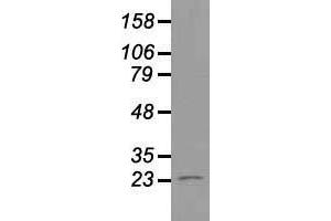 Western blot analysis of 35 µg of cell extracts from human Liver carcinoma (HepG2) cells using anti-NEUROG1 antibody. (Neurogenin 1 antibody)