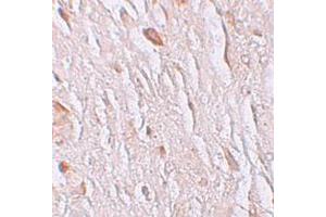 Immunohistochemistry (IHC) image for anti-Solute Carrier Family 39 (Zinc Transporter), Member 7 (SLC39A7) (N-Term) antibody (ABIN1031683) (SLC39A7 antibody  (N-Term))