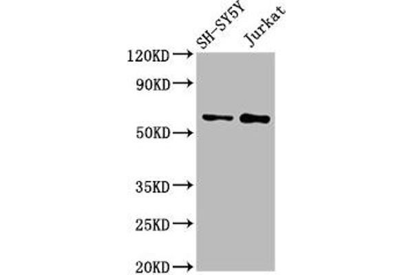 MGAT4B antibody  (AA 380-522)