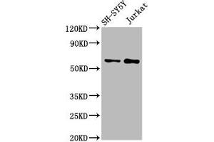 Western Blot Positive WB detected in: SH-SY5Y whole cell lysate, Jurkat whole cell lysate All lanes: MGAT4B antibody at 3 μg/mL Secondary Goat polyclonal to rabbit IgG at 1/50000 dilution Predicted band size: 64, 65 kDa Observed band size: 64 kDa (MGAT4B antibody  (AA 380-522))
