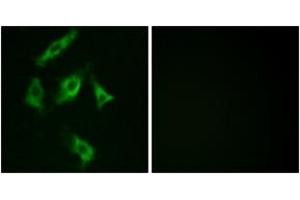 Immunofluorescence analysis of COS7 cells, using Stathmin 1 (Ab-15) Antibody. (Stathmin 1 antibody  (AA 5-54))