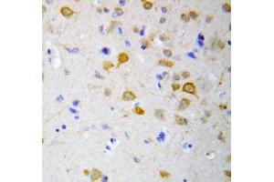 Anti-5HT2A Receptor antibody, IHC(P) IHC(P): Rat Brain Tissue