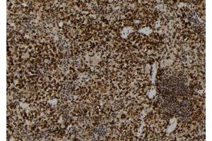 ABIN6272859 at 1/100 staining Mouse spleen tissue by IHC-P. (PADI2 antibody  (Internal Region))