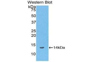 Western Blotting (WB) image for anti-Lipotropin, beta - (AA 179-267) antibody (ABIN1858144) (Lipotropin, beta - (AA 179-267) antibody)