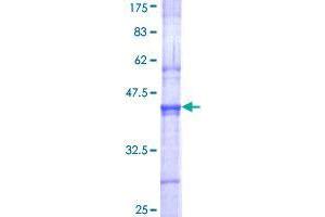 SENP3 Protein (AA 301-400) (GST tag)