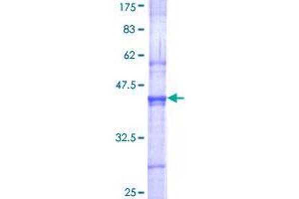 SENP3 Protein (AA 301-400) (GST tag)