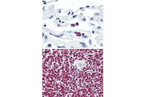 Immunohistochemical (Formalin/PFA-fixed paraffin-embedded sections) staining in human neutrophils (A) and human spleen (B) with LGR6 polyclonal antibody . (LGR6 antibody  (Internal Region))