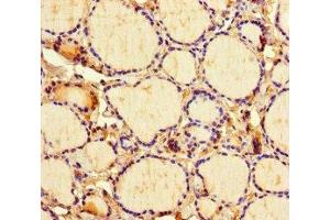 Immunohistochemistry of paraffin-embedded human thyroid tissue using ABIN7158468 at dilution of 1:100 (ICE1 (AA 1213-1505) antibody)