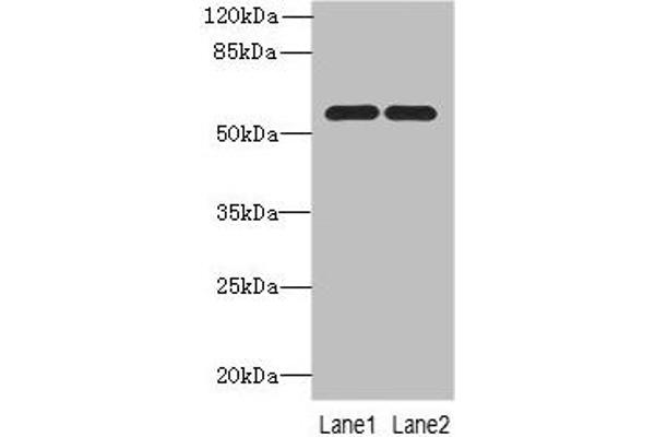 PSMD12 antibody  (Regulatory Subunit 12)