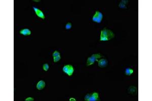 Immunofluorescent analysis of MCF-7 cells using ABIN7161861 at dilution of 1:100 and Alexa Fluor 488-congugated AffiniPure Goat Anti-Rabbit IgG(H+L) (NCOA5 antibody  (AA 112-283))