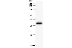 Western Blotting (WB) image for anti-Zinc Finger Protein 384 (ZNF384) antibody (ABIN931115) (ZNF384 antibody)