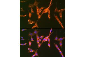 Immunofluorescence (IF) image for anti-Insulin-Like Growth Factor 2 Receptor (IGF2R) antibody (ABIN1678848)