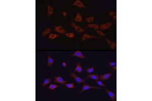 Immunofluorescence (IF) image for anti-Activating Transcription Factor 6 (ATF6) (AA 1-190) antibody (ABIN1512605)