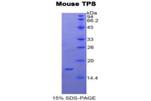 SDS-PAGE (SDS) image for Tryptase alpha/beta 1 (TPSAB1) (AA 149-273) protein (His tag) (ABIN1878254)