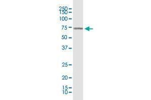 KLF11 monoclonal antibody (M03), clone 10D8. (KLF11 antibody  (AA 404-512))