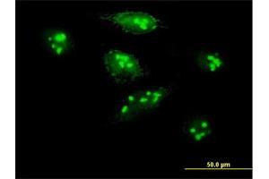 Immunofluorescence of purified MaxPab antibody to MKI67IP on HeLa cell. (NIFK antibody  (AA 1-293))