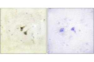 Immunohistochemistry analysis of paraffin-embedded human brain tissue, using PBK/TOPK (Ab-9) Antibody. (PBK antibody  (AA 1-50))