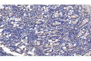 Immunohistochemistry (IHC) image for anti-Anti-Mullerian Hormone (AMH) (AA 453-560) antibody (ABIN7425782)