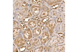 Immunohistochemistry of paraffin-embedded rat kidney using TNK2 Rabbit pAb (ABIN3016189, ABIN3016190, ABIN3016191, ABIN1683072 and ABIN6219613) at dilution of 1:50 (40x lens). (TNK2 antibody  (AA 70-385))